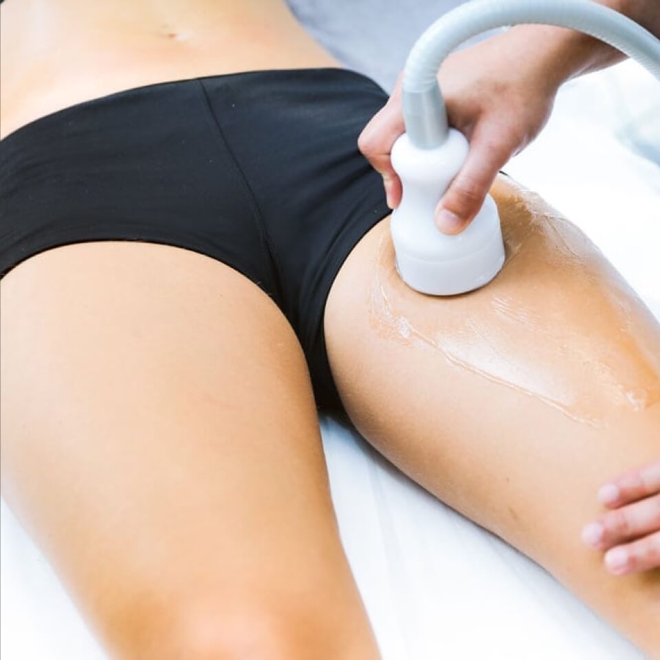 Crioterapia fisioestetica